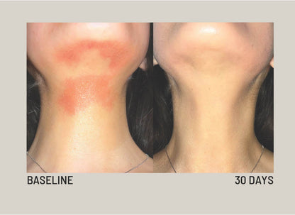 SIV O-Biome Serum